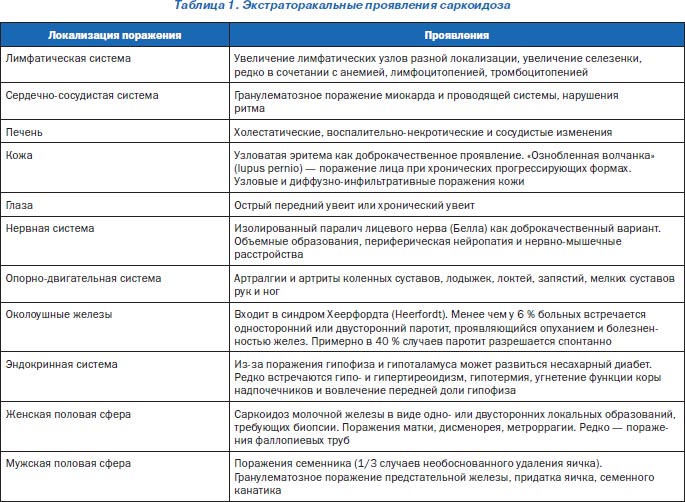 Диагностика и лечение саркоидоза - Клиники Беларуси