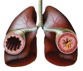 Особливості персистування бронхіальної астми у школярів залежно від кортизол-продукуючої функції надниркових залоз