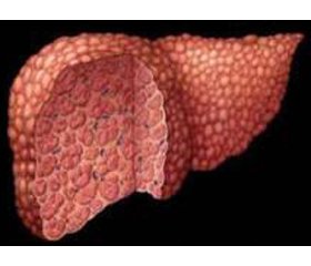 Характеристика показателей функционального состояния щитовидной железы у больных хроническими гепатитами невирусного генеза