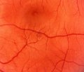 Новые аспекты патогенеза  и лечения диабетической ретинопатии