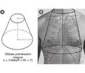 Method of estimating the thoracic fluid content, based on anthropometric data of the patient and determining the electrical impedance of the chest