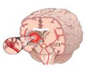 Classification of posterior circulation stroke: a narrative review of terminology and history