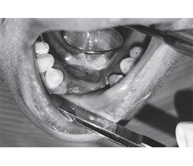 Клінічна характеристика потенційно злоякісних утворень слизової оболонки порожнини рота та червоної облямівки