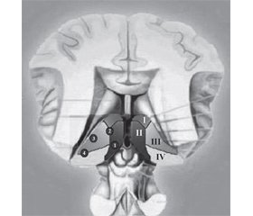 Clinical vascular syndromes of thalamic strokes in anterior and paramedian vascular territories: a prospective hospital-based cohort study