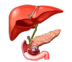 Features of nutritional support in patients with severe acute necrotizing pancreatitis