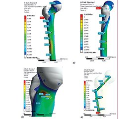 Результати експериментального моделювання напружень на фіксатори при металоостеосинтезі черезвертлюгових переломів