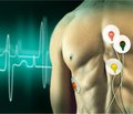 Застосування нових технологій у дослідженні  хворих з інфарктоподібними електрокардіограмами