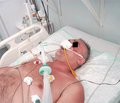 Качество жизни и уровень летальности у пациентов, которым проводили длительную искусственную вентиляцию легких